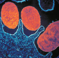 Bakterie - Bakterien (Helicobacter Pylori) Bakterie - Bakterien (Helicobacter Pylori)