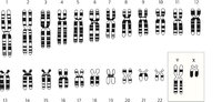 Chromosomensatz Chromosomensatz