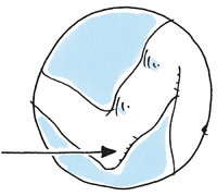 Ellenbogen Ellenbogen